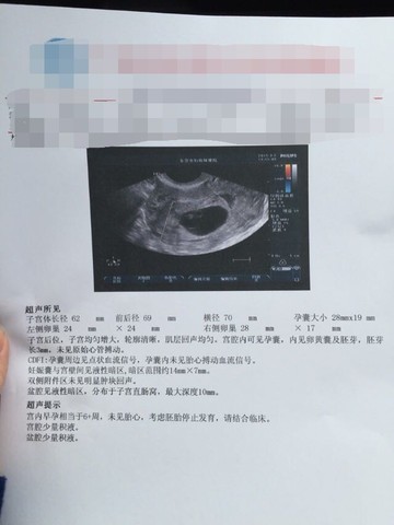 journal_insert_pic_203181818