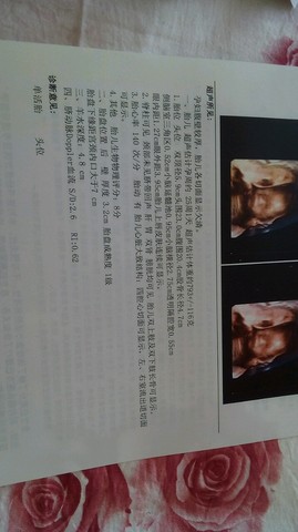journal_insert_pic_203501725