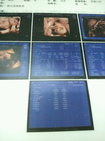 journal_insert_pic_204359358