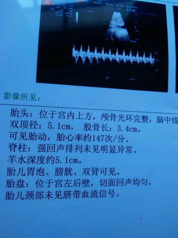 journal_insert_pic_204625909