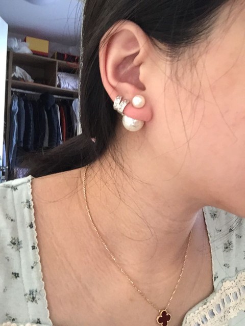 怀孕后脖子变黑,还有颈纹,肿么办?