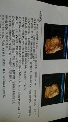 journal_insert_pic_205766583