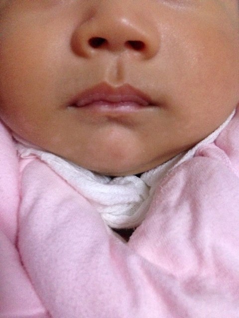 宝宝嘴巴上的白点是什么?