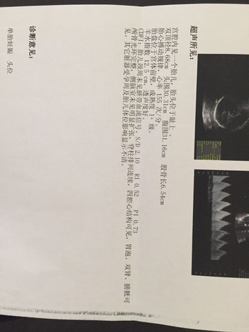journal_insert_pic_205795494