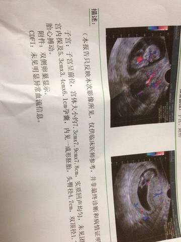 journal_insert_pic_207700320