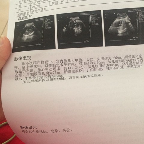 journal_insert_pic_210247459