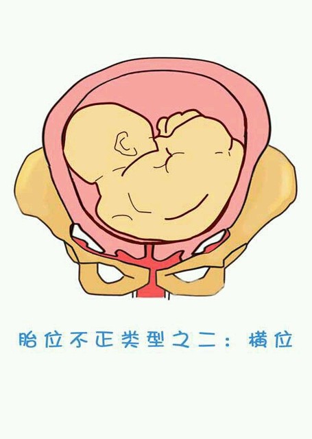 胎儿左枕横位胎儿图片图片