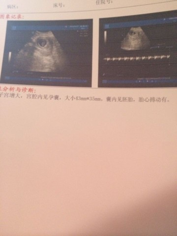 journal_insert_pic_211036921