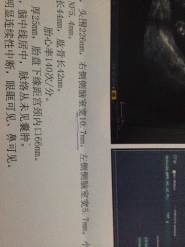journal_insert_pic_212292952