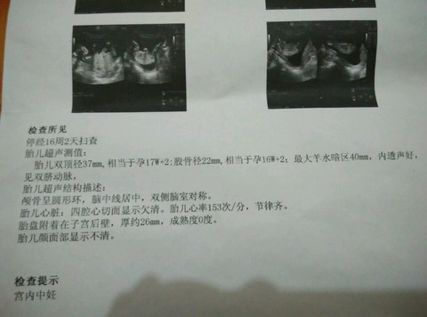 journal_insert_pic_213369515