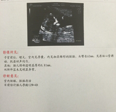 journal_insert_pic_215525679