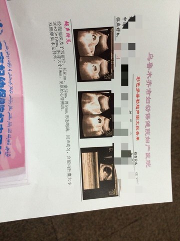 journal_insert_pic_217876526
