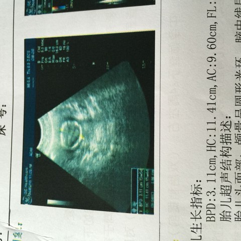 journal_insert_pic_217919920