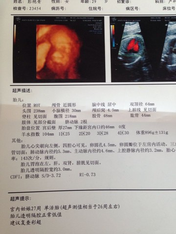 journal_insert_pic_218987360