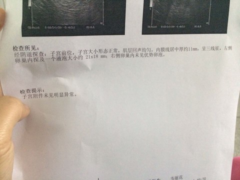 journal_insert_pic_220573498