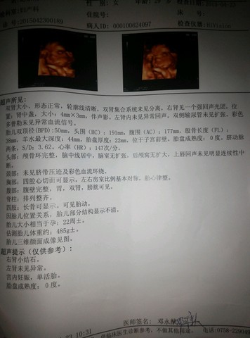 journal_insert_pic_222857849
