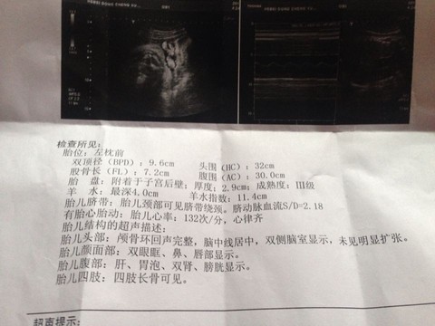 journal_insert_pic_223344608