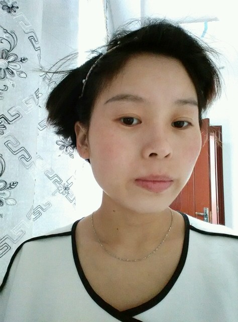 嘴边上长白色小斑块?急.