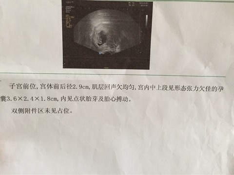 journal_insert_pic_232855180
