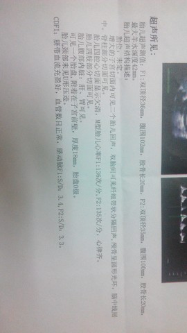 journal_insert_pic_233313973