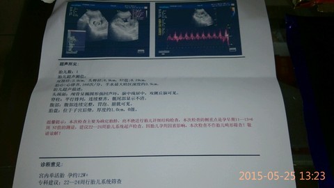 journal_insert_pic_234016694