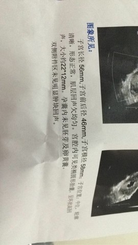 journal_insert_pic_234547366