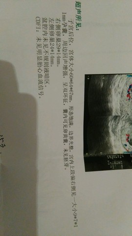 journal_insert_pic_235434656