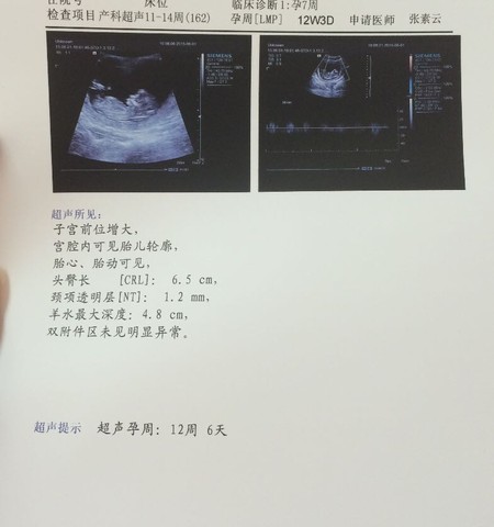 journal_insert_pic_237274684