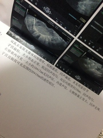 journal_insert_pic_237788626