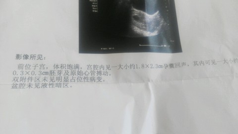 journal_insert_pic_239682667