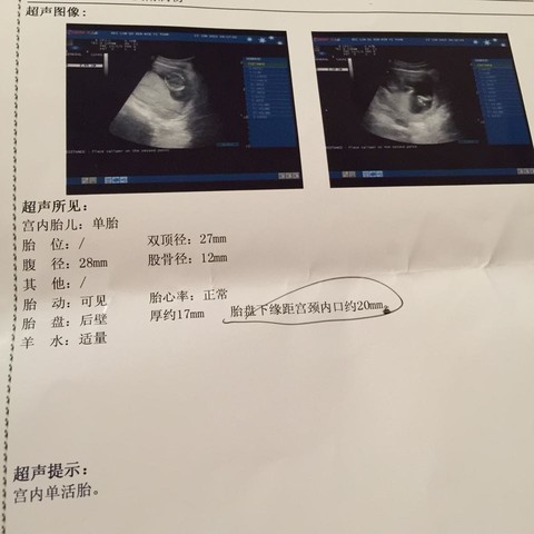 journal_insert_pic_247649860