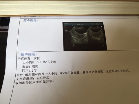 journal_insert_pic_248903927