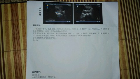 journal_insert_pic_249956246
