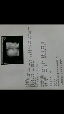 journal_insert_pic_250393256