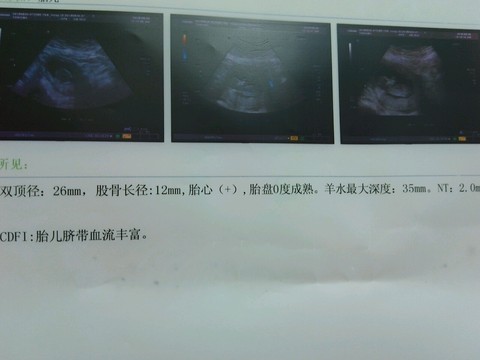 journal_insert_pic_250600956