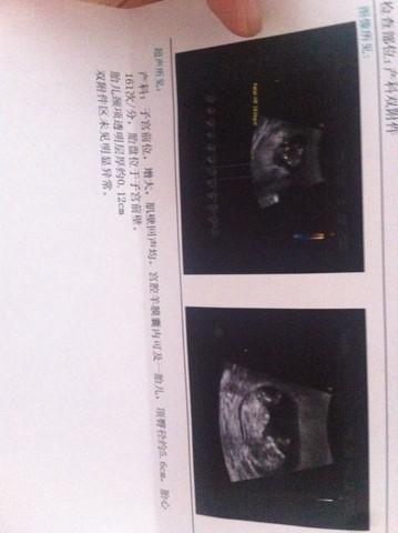 journal_insert_pic_255014060