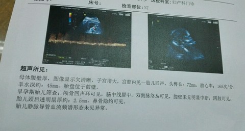 journal_insert_pic_254905966