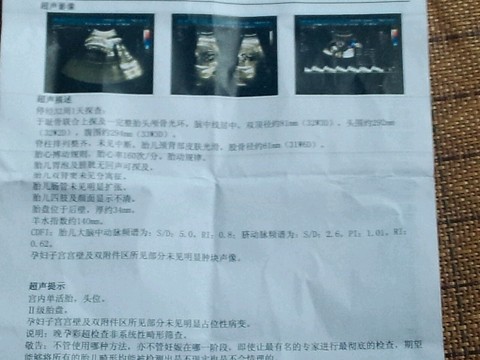 journal_insert_pic_258874072