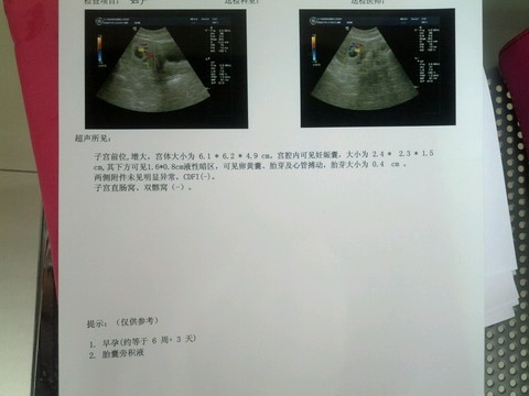 journal_insert_pic_258766084
