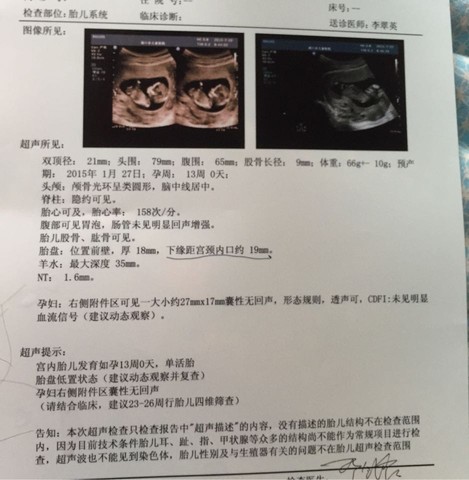 journal_insert_pic_259968083