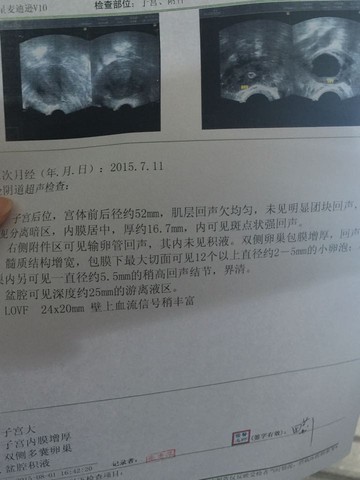 journal_insert_pic_264163817