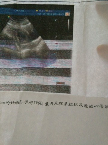 journal_insert_pic_267308464