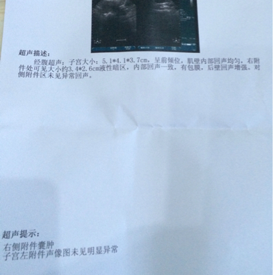 journal_insert_pic_267488130