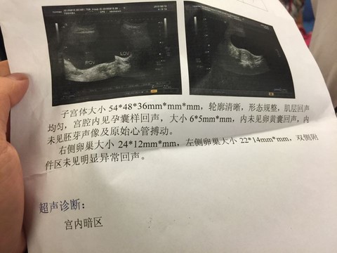 journal_insert_pic_272520861