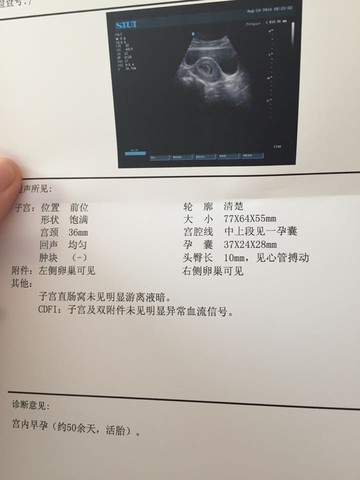 journal_insert_pic_273742026