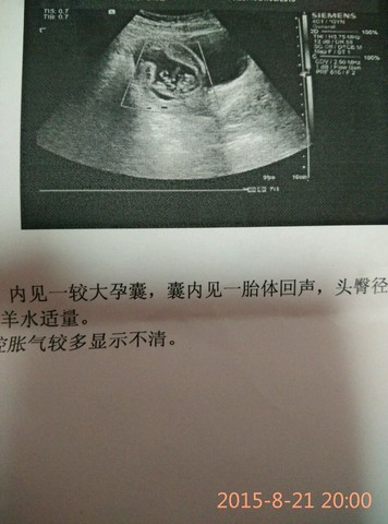 journal_insert_pic_274785027