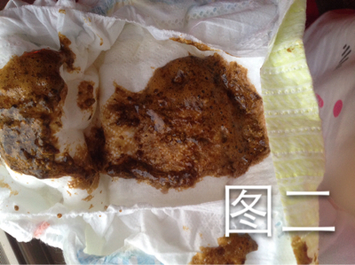 宝宝便秘几天,今天拉得大便怎麼是这颜色