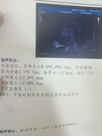 journal_insert_pic_277313967