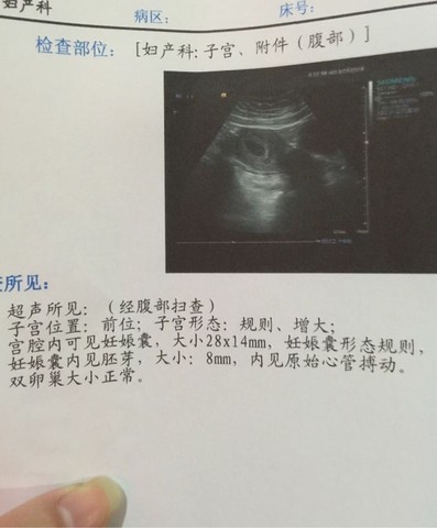 journal_insert_pic_279275141