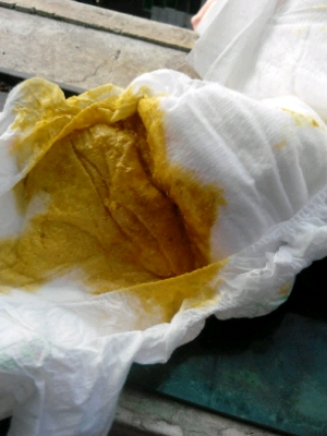 推荐回答 大便水分很多,可能是消化不良或者是肠道病毒感染,建议你